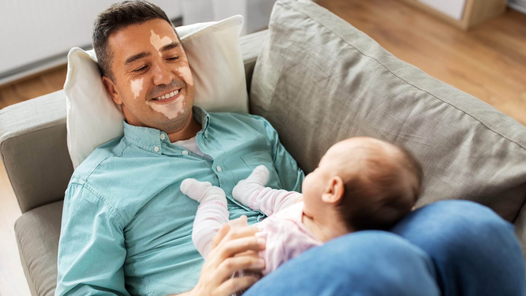 Un père avec un vitiligo avec son bébé